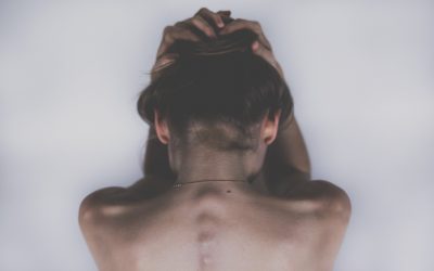 Ankylosing spondylitis flares – top tips to remember
