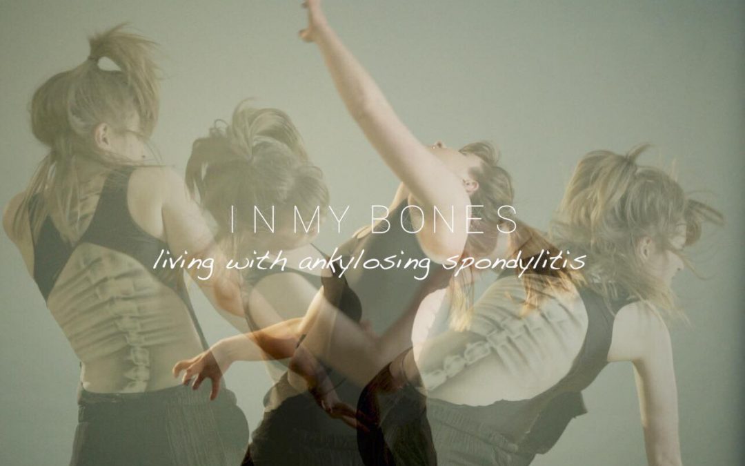 In My Bones – living with ankylosing spondylitis
