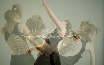 In My Bones – living with ankylosing spondylitis